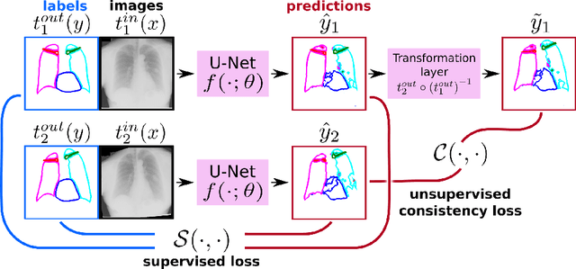 Figure 1 for Semi-Supervised Medical Image Segmentation via Learning Consistency under Transformations