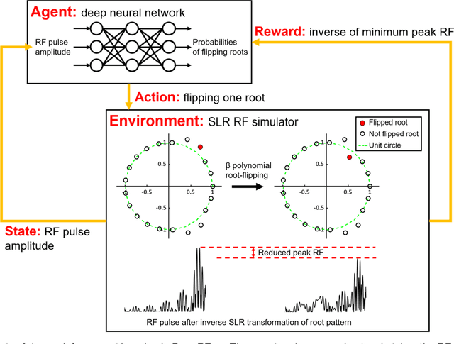 Figure 1 for Deep Reinforcement Learning Designed RF Pulse: $DeepRF_{SLR}$