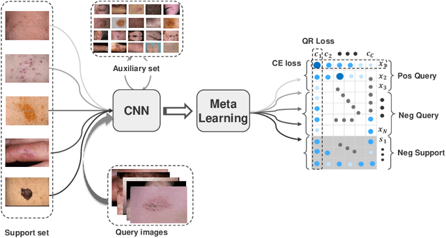 Figure 1 for Alleviating the Incompatibility between Cross Entropy Loss and Episode Training for Few-shot Skin Disease Classification