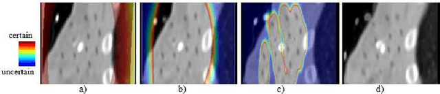 Figure 3 for An Investigation of Feature-based Nonrigid Image Registration using Gaussian Process
