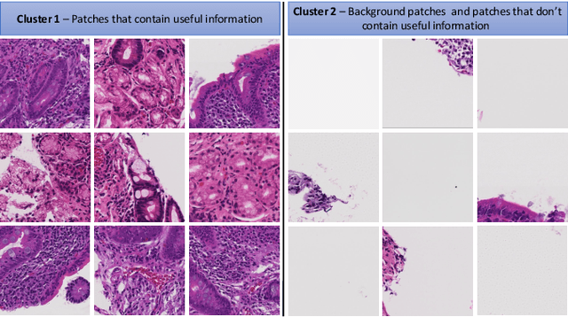 Figure 3 for CeliacNet: Celiac Disease Severity Diagnosis on Duodenal Histopathological Images Using Deep Residual Networks