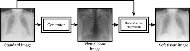 Figure 1 for Generation of Virtual Dual Energy Images from Standard Single-Shot Radiographs using Multi-scale and Conditional Adversarial Network