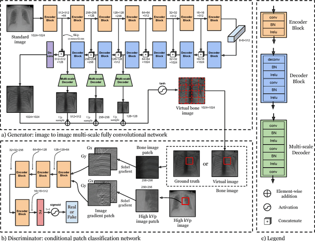 Figure 3 for Generation of Virtual Dual Energy Images from Standard Single-Shot Radiographs using Multi-scale and Conditional Adversarial Network