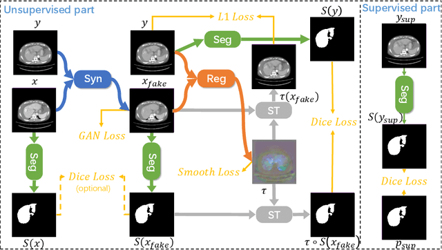 Figure 3 for JSSR: A Joint Synthesis, Segmentation, and Registration System for 3D Multi-Modal Image Alignment of Large-scale Pathological CT Scans