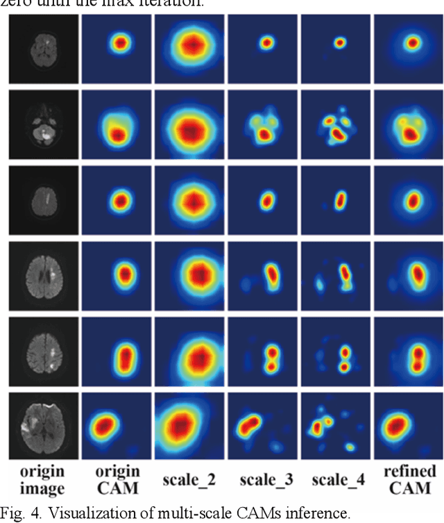 Figure 4 for Mixed-UNet: Refined Class Activation Mapping for Weakly-Supervised Semantic Segmentation with Multi-scale Inference
