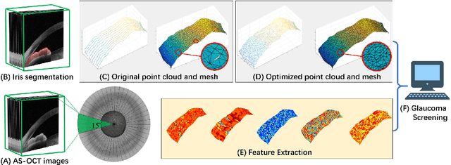 Figure 3 for Reconstruction and Quantification of 3D Iris Surface for Angle-Closure Glaucoma Detection in Anterior Segment OCT
