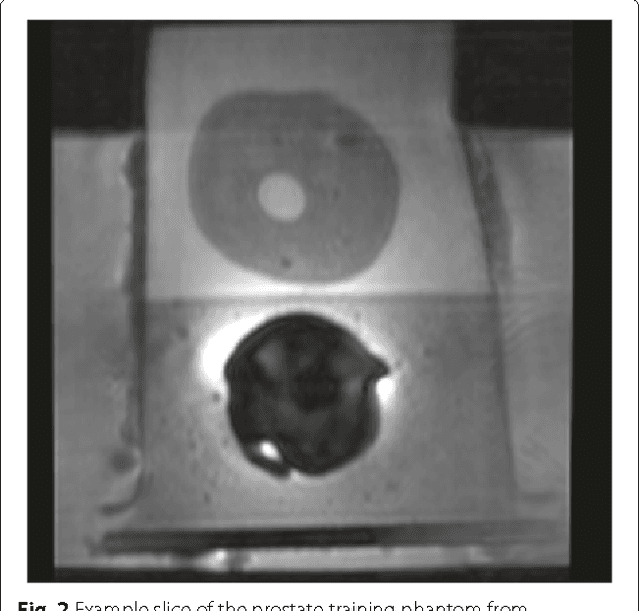 Figure 3 for Sparse Reconstruction of Compressive Sensing MRI using Cross-Domain Stochastically Fully Connected Conditional Random Fields