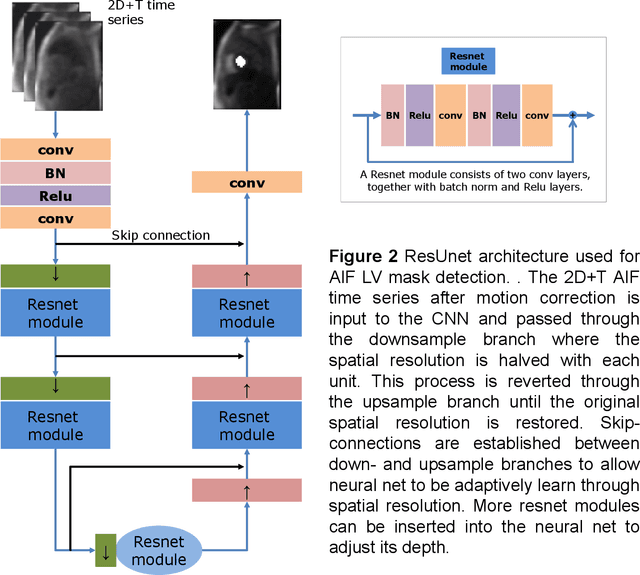 Figure 2 for Automated Detection of Left Ventricle in Arterial Input Function Images for Inline Perfusion Mapping using Deep Learning: A study of 15,000 Patients