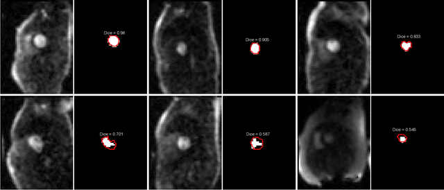 Figure 3 for Automated Detection of Left Ventricle in Arterial Input Function Images for Inline Perfusion Mapping using Deep Learning: A study of 15,000 Patients