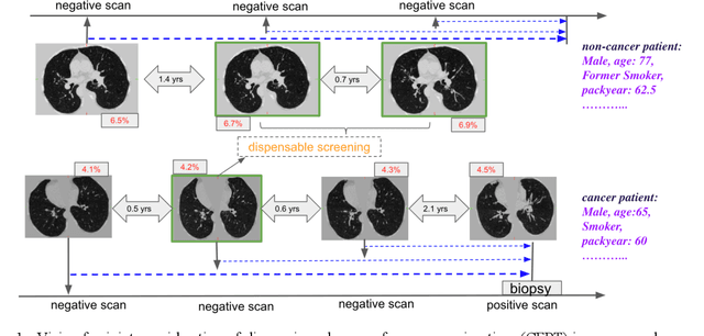 Figure 1 for Deep Multi-task Prediction of Lung Cancer and Cancer-free Progression from Censored Heterogenous Clinical Imaging
