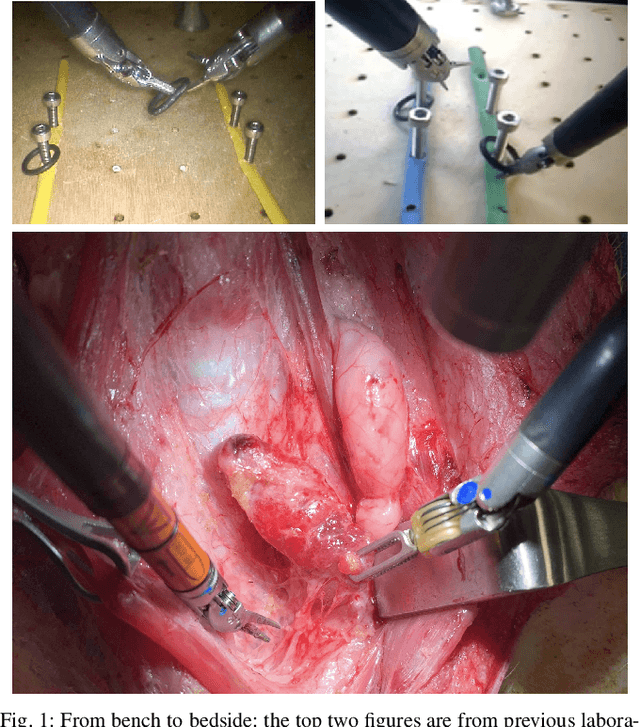 Figure 1 for From Bench to Bedside: The First Live Robotic Surgery on the dVRK to Enable Remote Telesurgery with Motion Scaling