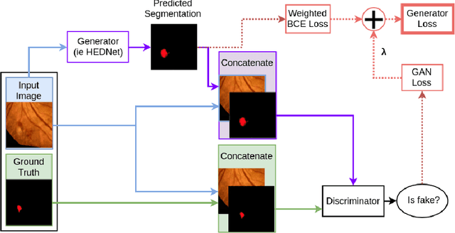 Figure 3 for Improving Lesion Segmentation for Diabetic Retinopathy using Adversarial Learning