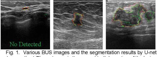 Figure 1 for AAU-net: An Adaptive Attention U-net for Breast Lesions Segmentation in Ultrasound Images