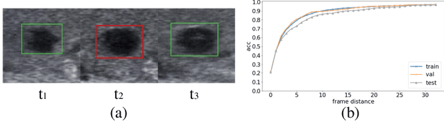 Figure 4 for Key-frame Guided Network for Thyroid Nodule Recognition using Ultrasound Videos