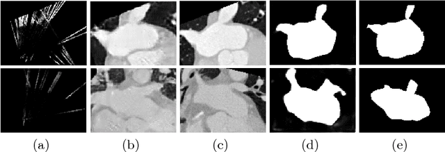 Figure 4 for More Knowledge is Better: Cross-Modality Volume Completion and 3D+2D Segmentation for Intracardiac Echocardiography Contouring