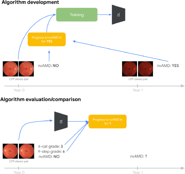 Figure 2 for Predicting Progression of Age-related Macular Degeneration from Fundus Images using Deep Learning