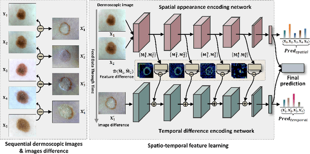 Figure 3 for Melanoma Diagnosis with Spatio-Temporal Feature Learning on Sequential Dermoscopic Images