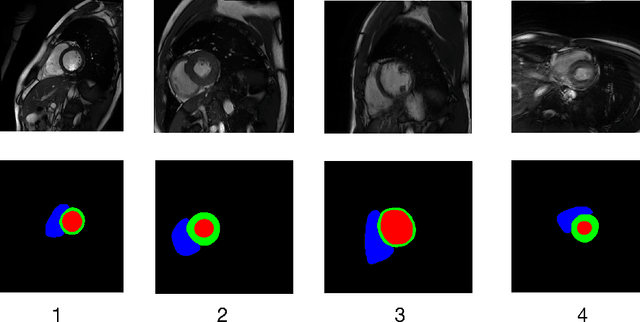 Figure 1 for Semi-Supervised Domain Generalization for Cardiac Magnetic Resonance Image Segmentation with High Quality Pseudo Labels