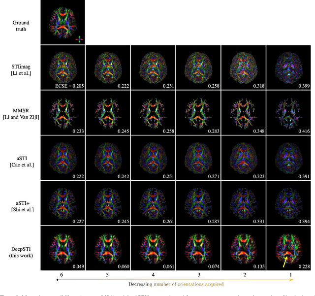 Figure 4 for DeepSTI: Towards Tensor Reconstruction using Fewer Orientations in Susceptibility Tensor Imaging