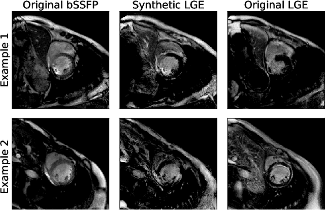 Figure 3 for Combining Multi-Sequence and Synthetic Images for Improved Segmentation of Late Gadolinium Enhancement Cardiac MRI