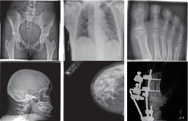 Figure 3 for Autoencoding the Retrieval Relevance of Medical Images