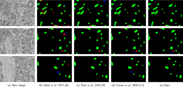 Figure 4 for Contrastive Learning for Mitochondria Segmentation