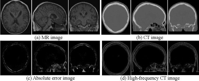 Figure 1 for Frequency-Supervised MR-to-CT Image Synthesis