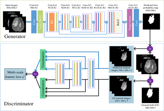Figure 1 for SegAN: Adversarial Network with Multi-scale $L_1$ Loss for Medical Image Segmentation