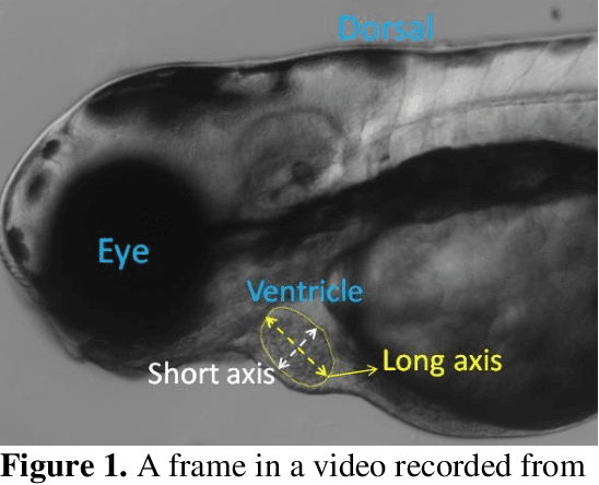 Figure 1 for Deep learning-based framework for cardiac function assessment in embryonic zebrafish from heart beating videos