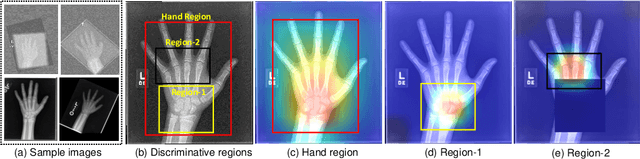 Figure 1 for Attention-Guided Discriminative Region Localization for Bone Age Assessment