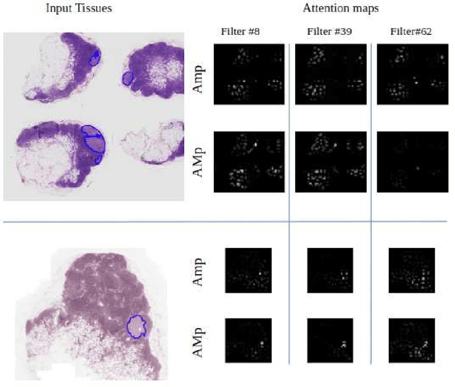 Figure 3 for Gigapixel Histopathological Image Analysis using Attention-based Neural Networks