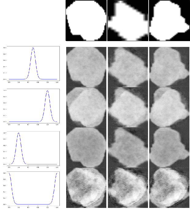 Figure 3 for Decoupling Shape and Density for Liver Lesion Synthesis Using Conditional Generative Adversarial Networks