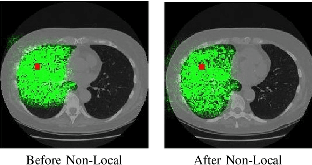 Figure 3 for Relational Modeling for Robust and Efficient Pulmonary Lobe Segmentation in CT Scans