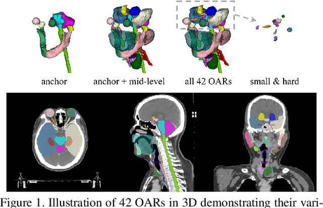 Figure 1 for Organ at Risk Segmentation for Head and Neck Cancer using Stratified Learning and Neural Architecture Search
