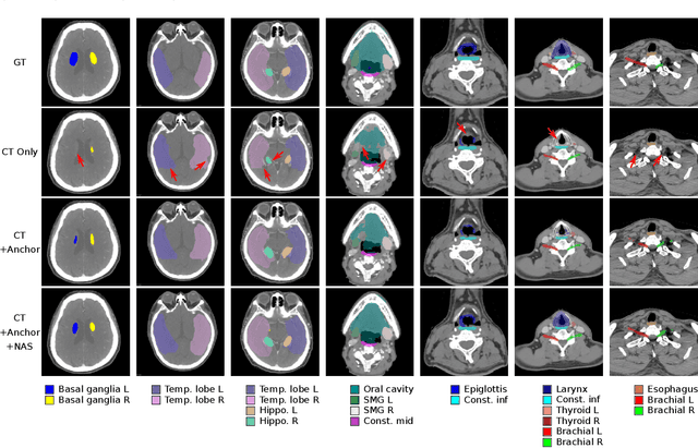 Figure 4 for Organ at Risk Segmentation for Head and Neck Cancer using Stratified Learning and Neural Architecture Search