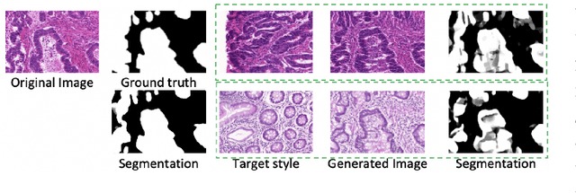 Figure 1 for Unlabeled Data Guided Semi-supervised Histopathology Image Segmentation