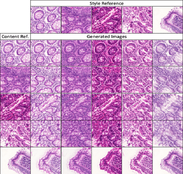 Figure 3 for Unlabeled Data Guided Semi-supervised Histopathology Image Segmentation