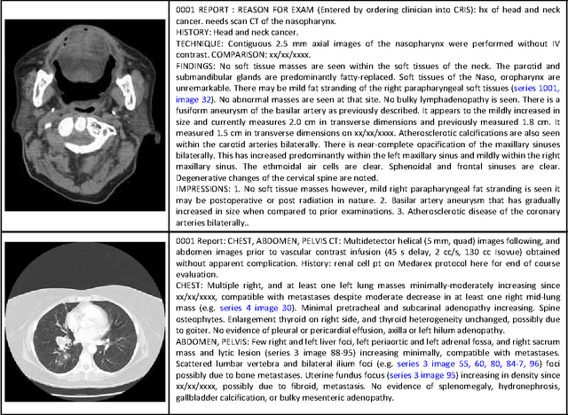 Figure 2 for Interleaved Text/Image Deep Mining on a Large-Scale Radiology Database for Automated Image Interpretation
