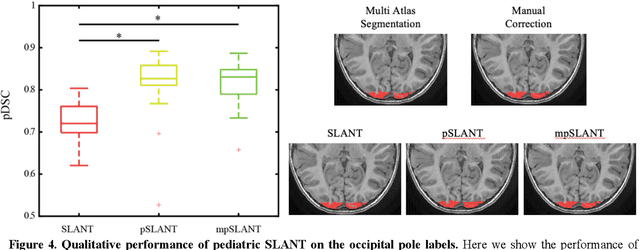 Figure 4 for Generalizing Deep Whole Brain Segmentation for Pediatric and Post-Contrast MRI with Augmented Transfer Learning