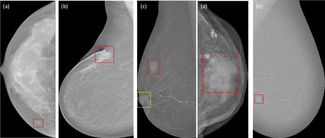 Figure 1 for Breast mass detection in digital mammography based on anchor-free architecture