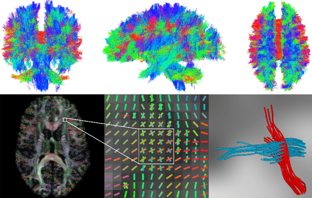 Figure 4 for Deep Learning the Shape of the Brain Connectome