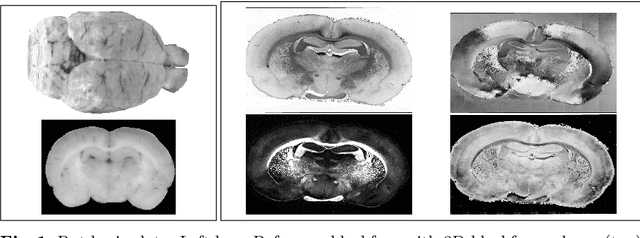 Figure 1 for Towards ultra-high resolution 3D reconstruction of a whole rat brain from 3D-PLI data