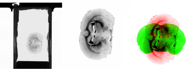 Figure 3 for Towards ultra-high resolution 3D reconstruction of a whole rat brain from 3D-PLI data