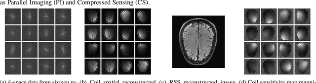 Figure 1 for Deep MRI Reconstruction with Radial Subsampling