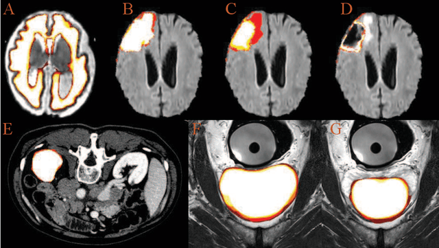 Figure 4 for Uncertainty Quantification in Medical Image Segmentation with Multi-decoder U-Net