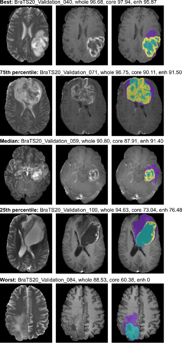 Figure 4 for nnU-Net for Brain Tumor Segmentation