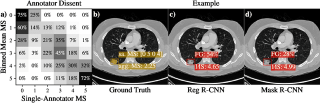 Figure 3 for Reg R-CNN: Lesion Detection and Grading under Noisy Labels