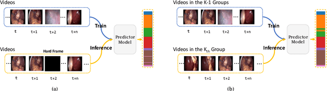 Figure 3 for Not End-to-End: Explore Multi-Stage Architecture for Online Surgical Phase Recognition