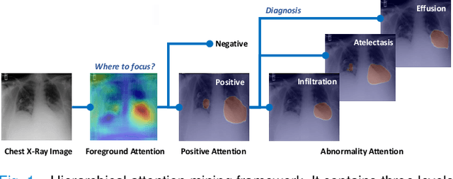 Figure 1 for Learning Hierarchical Attention for Weakly-supervised Chest X-Ray Abnormality Localization and Diagnosis