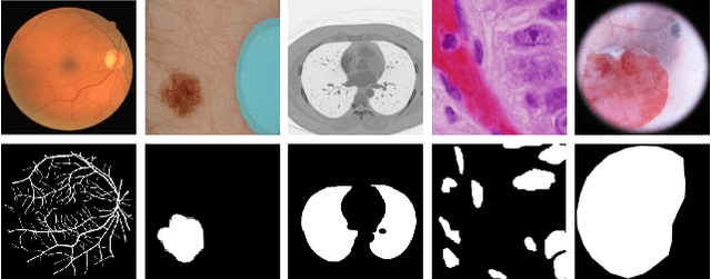 Figure 1 for Multi-level Context Gating of Embedded Collective Knowledge for Medical Image Segmentation